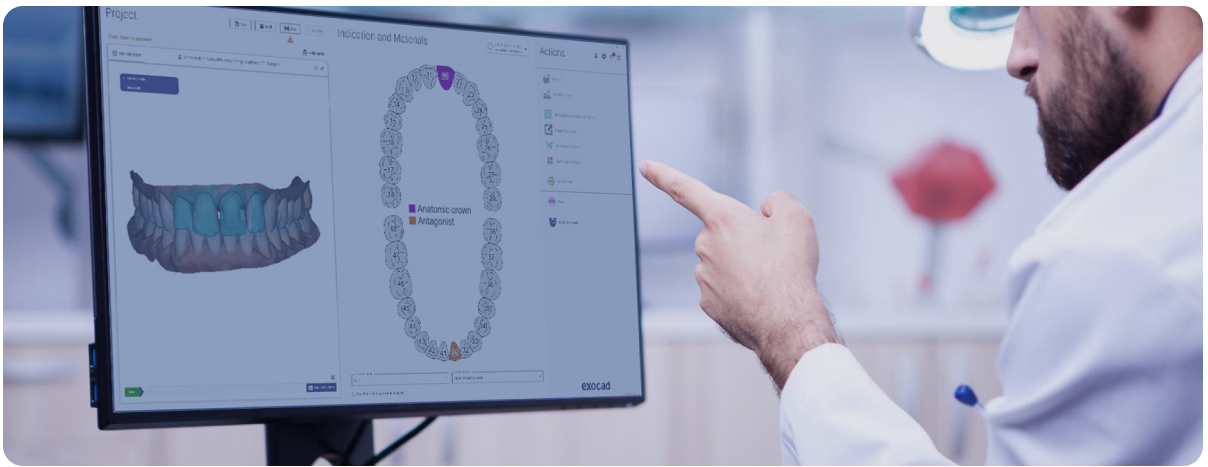 exocad软件,为现代牙科量身定制的数字化解决方案.png